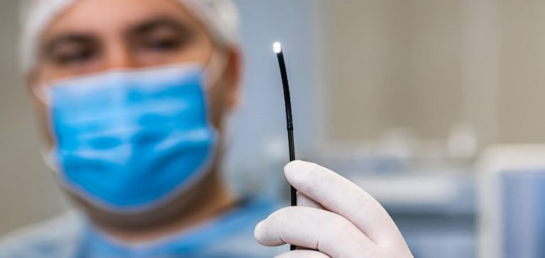 Gastromedic - Medicina para a Família Colonoscopia 1 Colonoscopia - Gastromedic