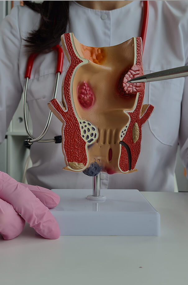 gastromedic polipectomia